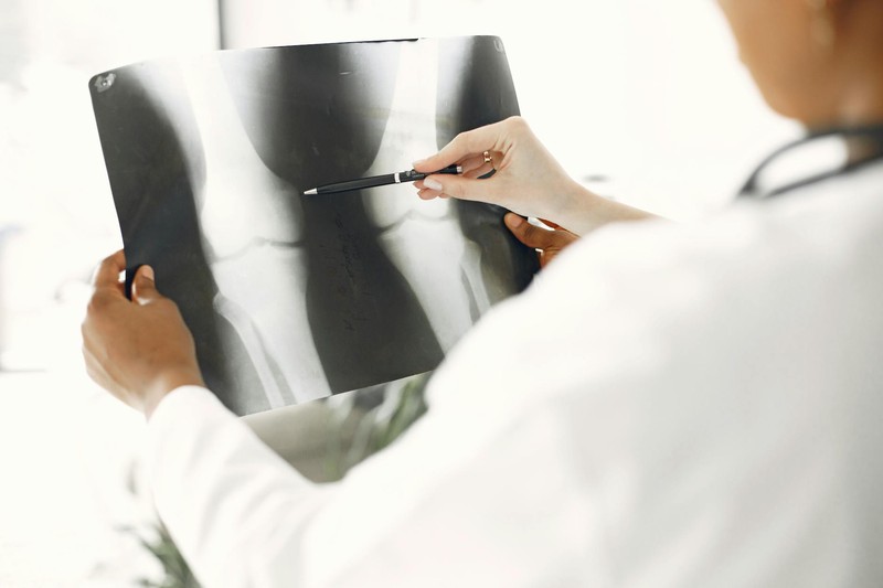 Radiologists Can't Tell Real X-Rays From AI Fakes