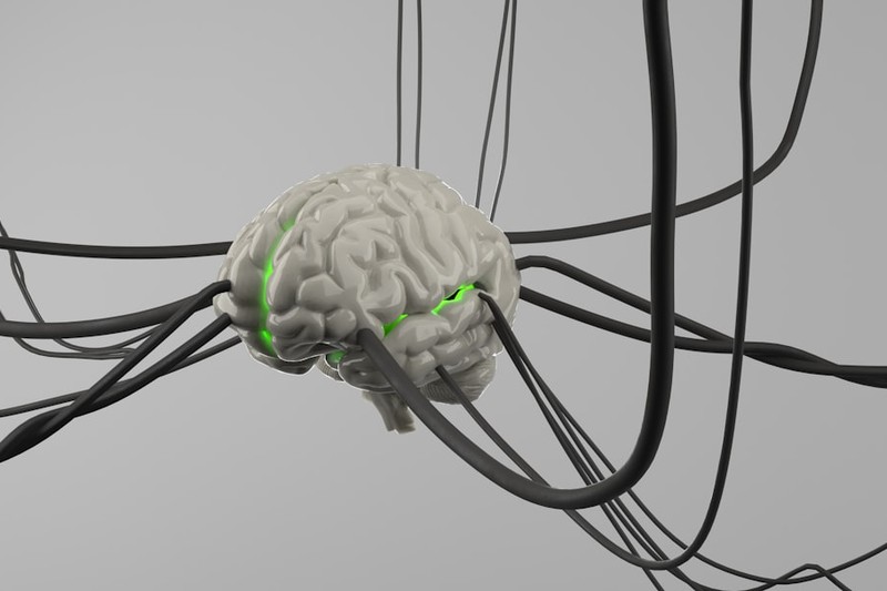 The Brain Implant Race Is Over. China Won.