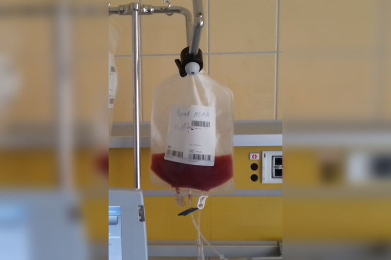 One Infusion, No More Transfusions: Base Editing Frees β-Thalassaemia Patients