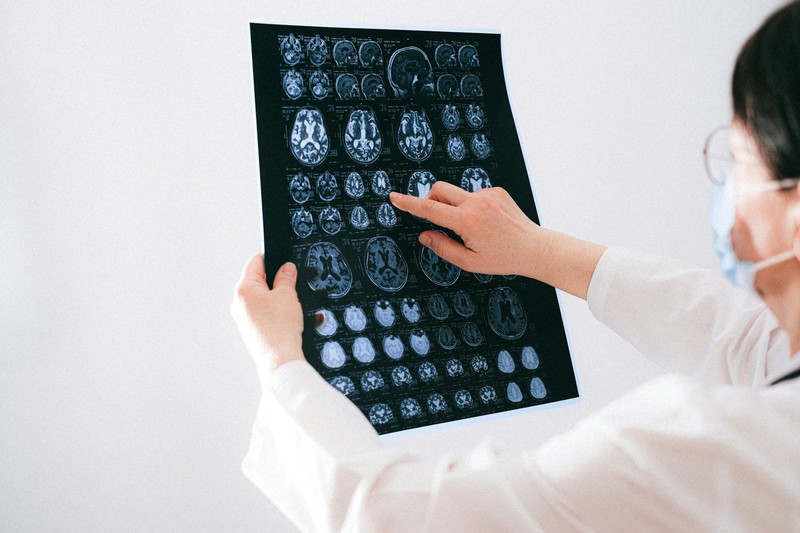 The Amyloid Hypothesis Just Failed Its Biggest Test