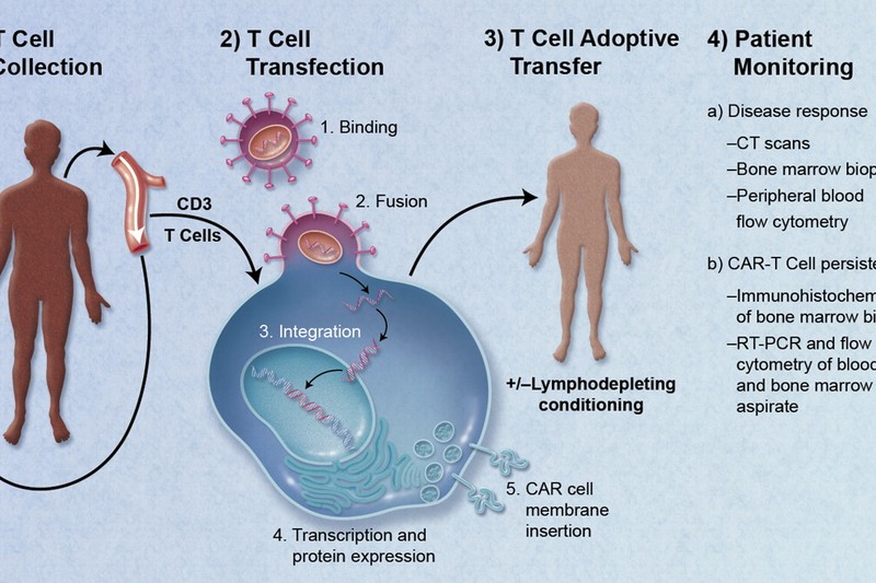 The Immune Cells That Won't Quit: World-First Trial Puts Blood Cancer Into Remission