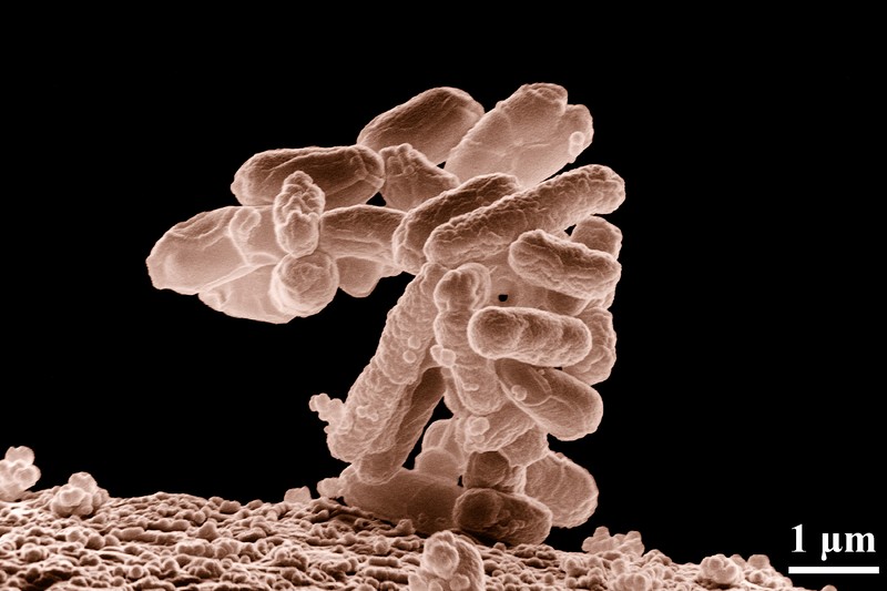 Life Needs 20 Amino Acids. These Cells Run Fine on 19.