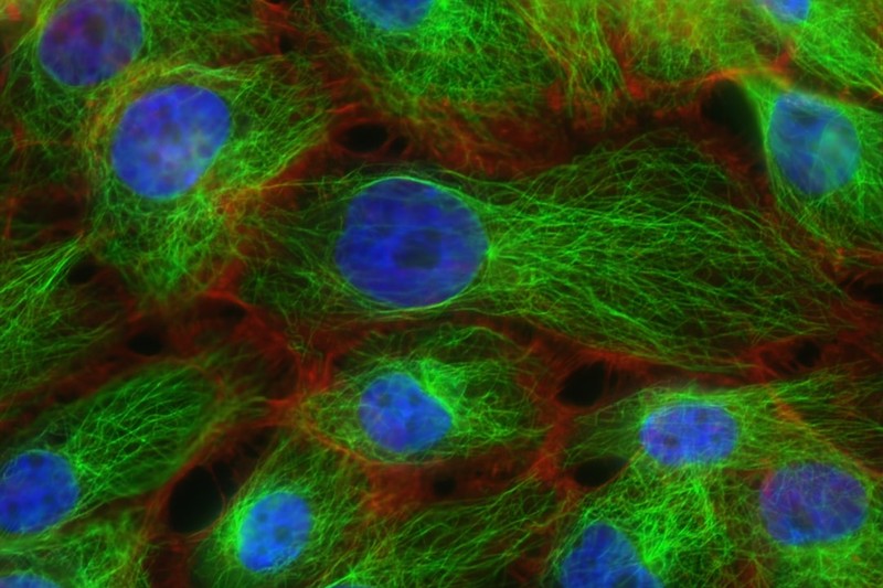A Single DNA Test Could Spare Millions of Women from Chemotherapy