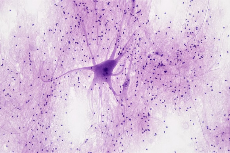 Lab-Grown Brain Cells Learned to Play Doom. They're Not Very Good at It.